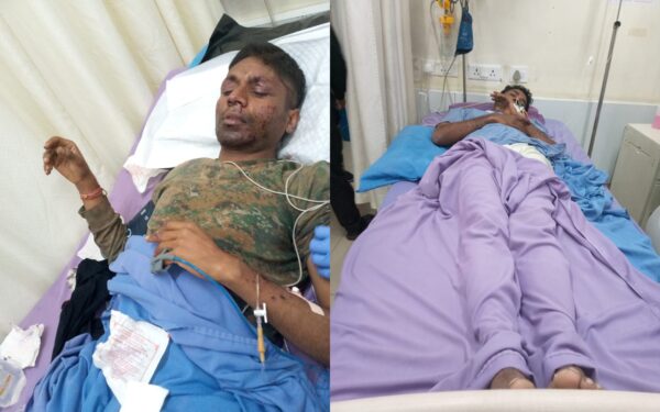 IED blast victims undergoing treatment at Medica