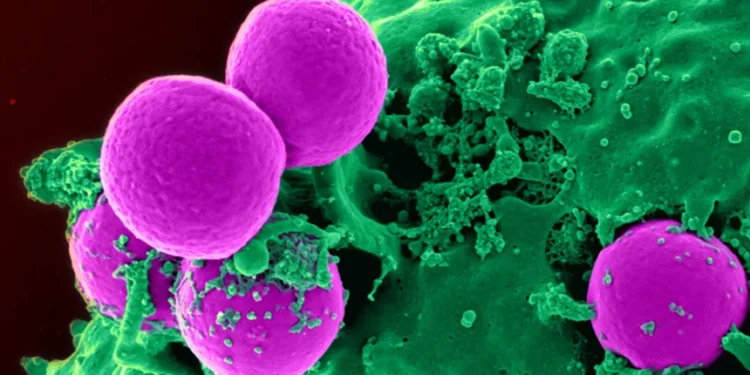 40 Million Deaths from Antibiotic-Resistant Infections Predicted by 2050: Study