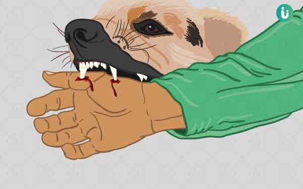 Jharkhand Steps Up Rabies Control Drive, Vaccine Stock Made Mandatory in Government Hospitals