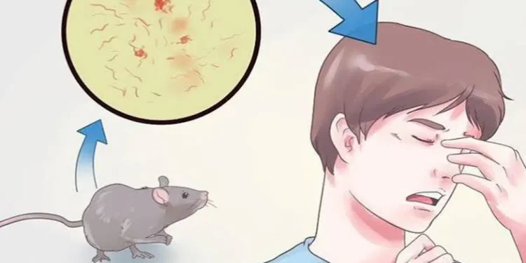 Rat Fever Cases Surge in Ranchi, Over 130 Infected in Two Months